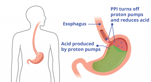 proton pump inhibitors