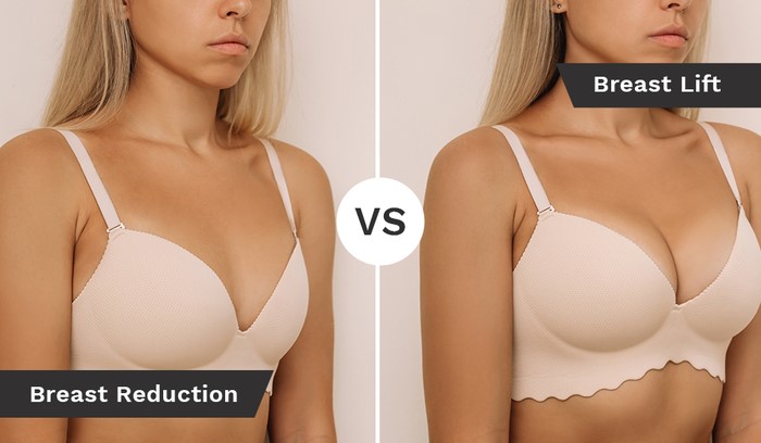 Breast Lift vs Breast Reduction