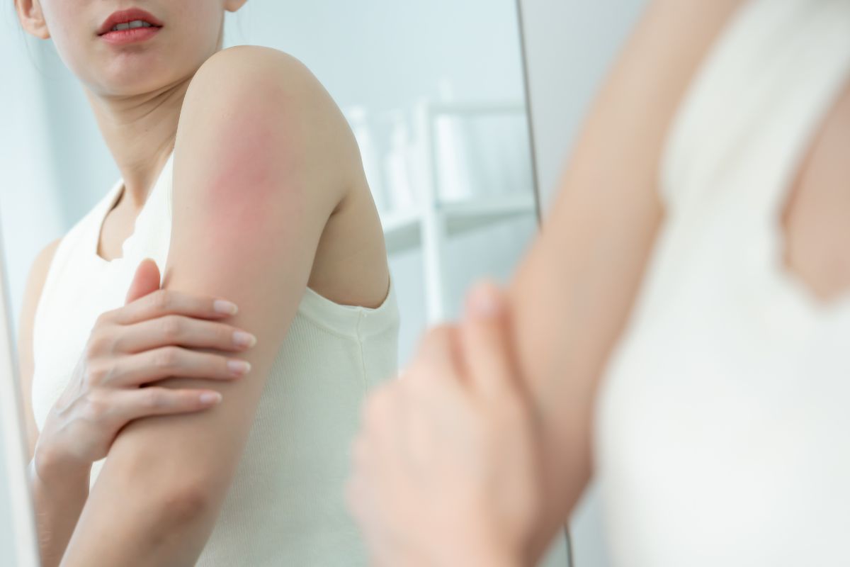 Skin Cancer Screening